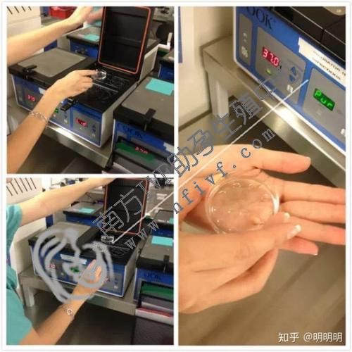 武汉借卵机构-武汉市妇幼保健院的体外受精过程。
