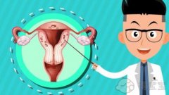 试管婴儿的名人都是谁：子宫内膜异位症如何影响身体？它能影响生育能力吗？